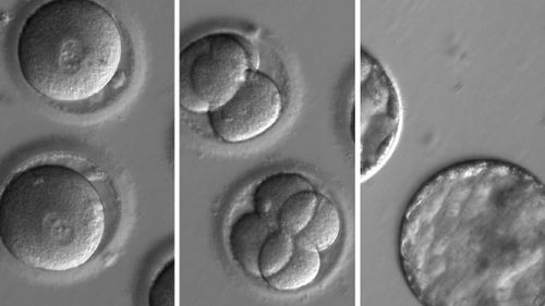 A composite image embryos developing after receiving a gene-correcting enzyme and sperm from a donor. (AAP)