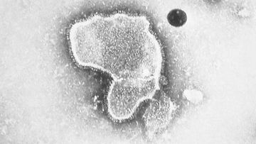 A human respiratory syncytial virus, also known as RSV.