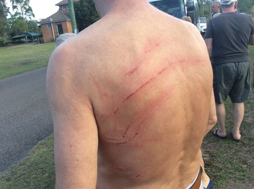 The man's back has large scratched on it from a kangaroo attack. (Kroosn Shuttle Service Pty Ltd/Facebook)