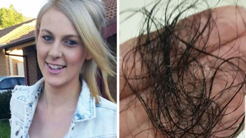 One of Ms Harrison has been suffering from hair loss, as well as many other health complaints.