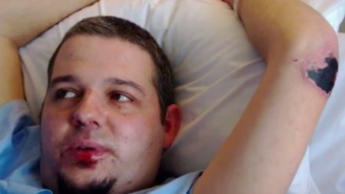 Paul Goodfellow contracted the B strain of meningococcal in 2013. (9NEWS)