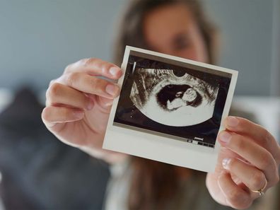 Woman showing pregnancy scan