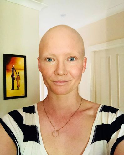Briony Benjamin lost all her hair during treatment.