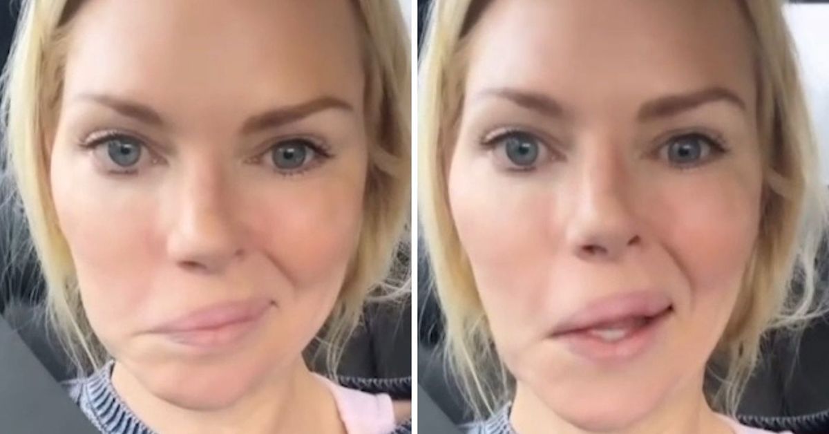 Love Island Australia host Sophie Monk unable to smile as her face is temporarily paralysed