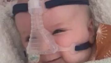 Mackenzie Casella was a much loved baby girl who didn&#x27;t make it to her first birthday after being diagnosed with spinal muscular atrophy (SMA).