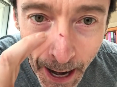 Hugh Jackman