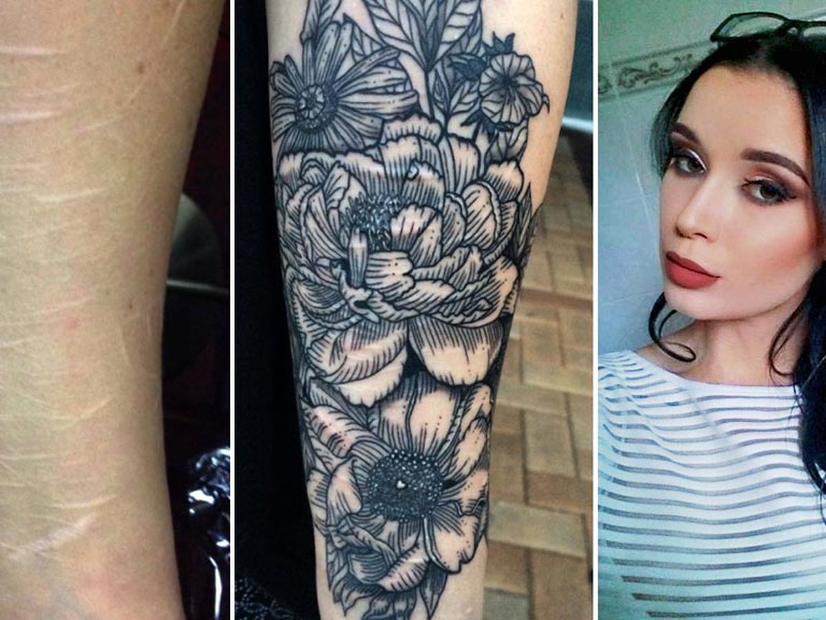 Brisbane woman inundated with requests after offering to tattoo people's  scars for free