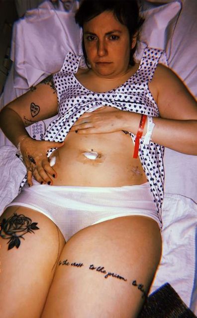 Lena Dunham has surgery to remove ovary after undergoing total hysterectomy  - 9Celebrity