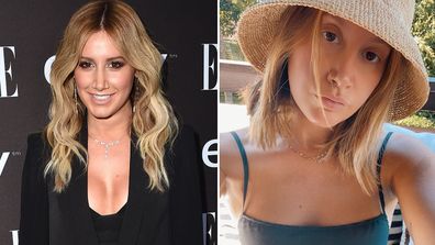 Ashley Tisdale, breast implant removal surgery