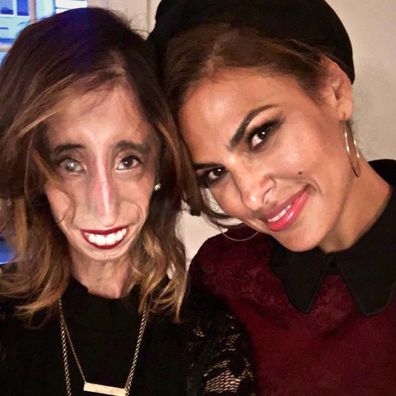 Lizzie Velasquez's work as an anti-bullying activist has seen her unite with celebrities like Eva Mendes. 