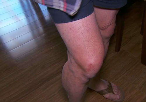 Mr DeGuara was left with a number of bruises. (9NEWS)