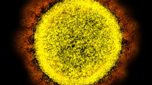 Coronaviruses are named for the spikes that cover their outer surface like a crown, or corona in Latin.