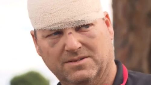 Malcolm Woodford spoke to 9NEWS following the brutal attack. Picture: 9NEWS