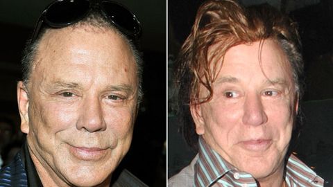 Saving face: Mickey Rourke shows off plastic surgery aftermath