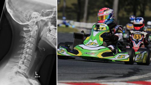 Exclusive: Aussie karting teen breaks ‘gallow bone’ during race