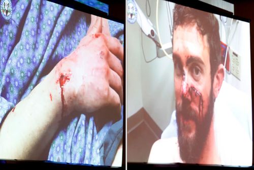 A video was shown by Colorado Parks and Wildlife media conference with Travis Kauffman showing his injuries.