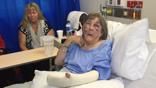 The elderly victim, Mavis, speaks from her hospital bed. (Alexis Daish/9NEWS)