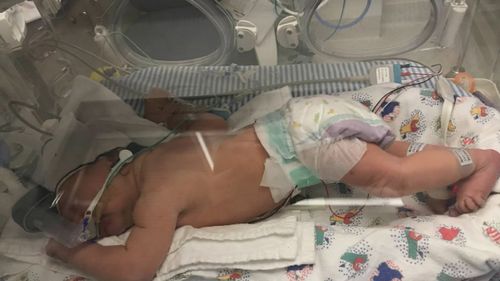 Surgeons performed an emergency caesarean on Lisa Otsen in 2019 after monitoring showed Landon had an abnormal heart rate.