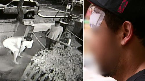 CCTV footage from the scene (left), and the backpacker's injuries (right). (9NEWS)