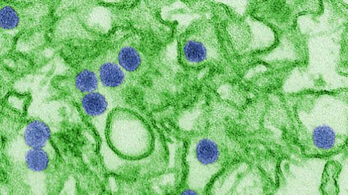 The Zika virus under a microscope. (AAP)