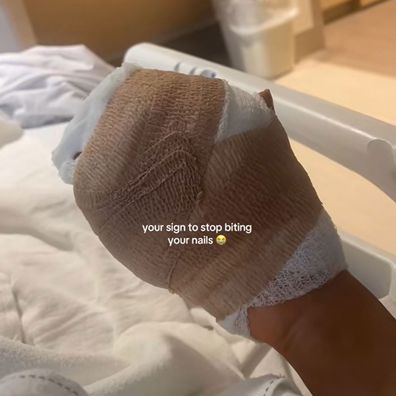 Woman hospitalised after nail biting