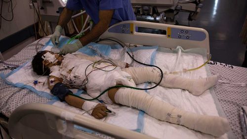 A Palestinian medic gives treatment to a wounded girl in the ICU of the Shifa hospital in Gaza City.