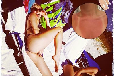 Yeowch! Looks like Miley forgot her sunscreen while lounging on the beach in Tampa during her Bangerz tour. <br/><br/>"Quick change today is gonna be a realllllllllll bi----…" she tweeted under a picture of her sunburnt chest. Uh yeah, you can say that again, girl! <br/><br/>