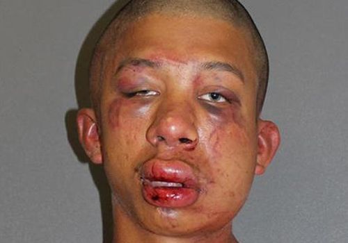 Paedophile teen beaten up by victim's dad sentenced to 25 years