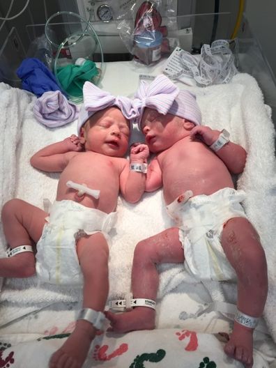 Twins Emma and Julia, shortly after their birth. 