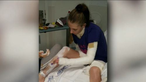 Some of the burns were so deep they went through the full thickness of her skin. (9NEWS)
