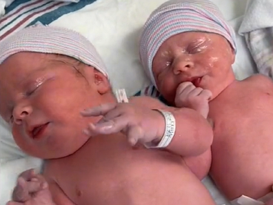 twins born with key size difference TikTok