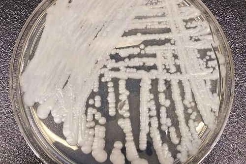 This undated photo made available by the Centers for Disease Control and Prevention shows a strain of Candida auris cultured in a petri dish at a CDC laboratory.