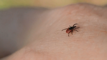 The disease is spread by a bacteria found in ticks.