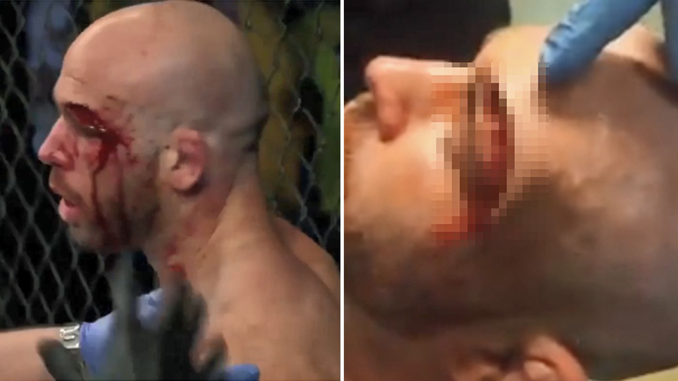 MMA fighter suffers gruesome head cut at Cage Warriors 93
