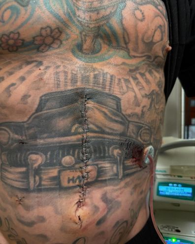 Carey hart in hospital