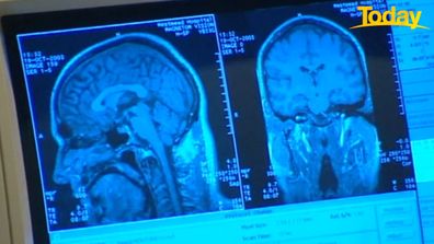 Neuroscientist, Dr Rahul Jandial said new research shows COVID-19 can shrink parts of the brain.