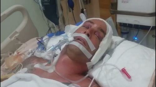 Ben French has been fighting for life since crashing his scooter last Wednesday. (9NEWS)