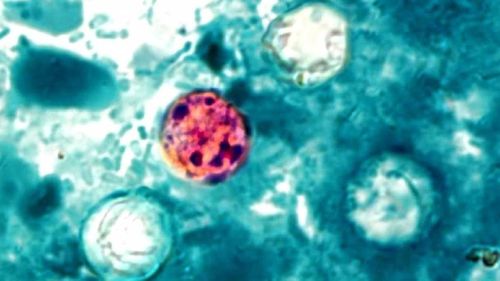 A microscopic image of the cyclospora parasite.