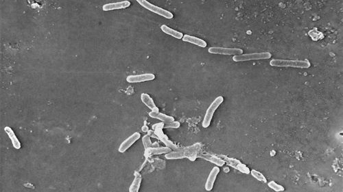 Electron microscope image shows rod-shaped Pseudomonas aeruginosa bacteria