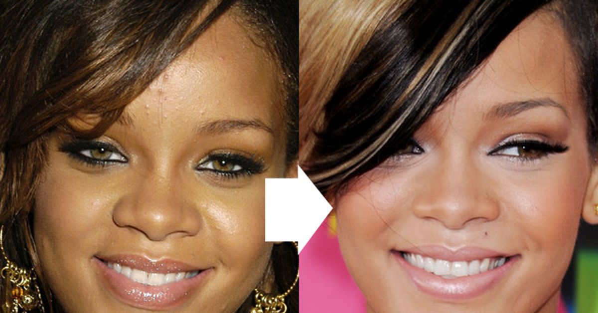 Nine surgeons say Rihanna has had a nose job.