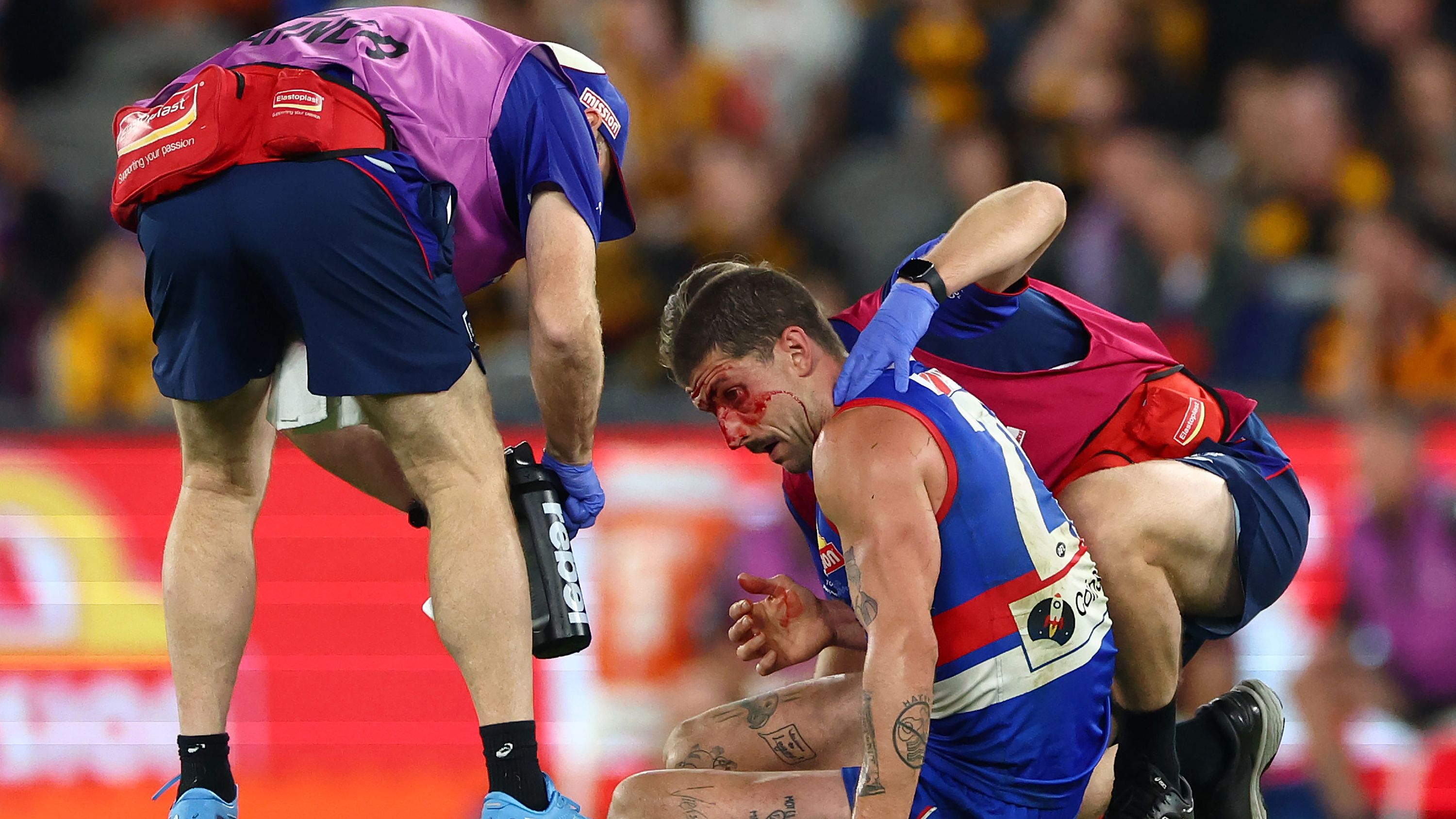 Liberatore copped a boot to the head.