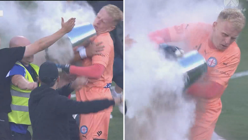 Football news 2022: news 2022 Melbourne City goalkeeper Tom Glover left  bleeding from the head in violent ALeague protests