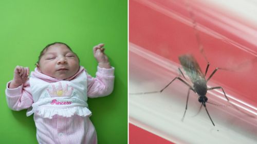 First baby born in Europe with Zika-caused microcephaly