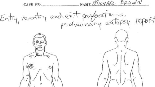 A detail from a preliminary autopsy showing the entry, re-entry and exit wounds from the six bullets that killed Michael Brown. (Dr Michael M. Baden)