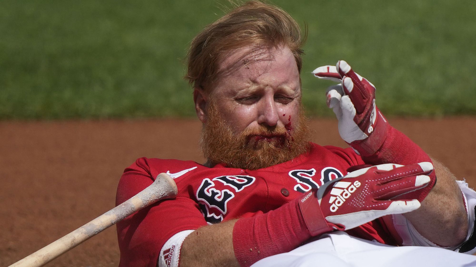 MLB news 2023: Spectator tumbles over railing into Red Sox bullpen