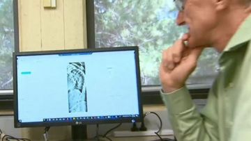 Researchers at a Western Australian university have discovered a bone scan can help predict a person&#x27;s risk of heart attack and stroke.