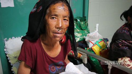 This woman is being treated in a Kathmandu hospital. (9NEWS)