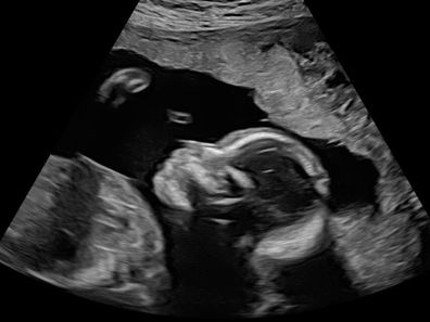 tracy vo pregnant with rainbow baby 9news presenter