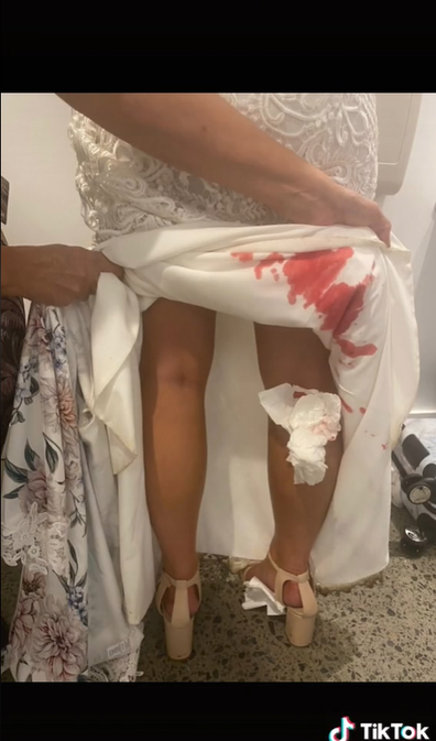 Bride's horrific discovery after first dance with new husband.
