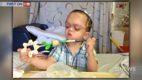 Pfeiffer syndrome is a rare condition that stops the skull from properly developing. (9NEWS)